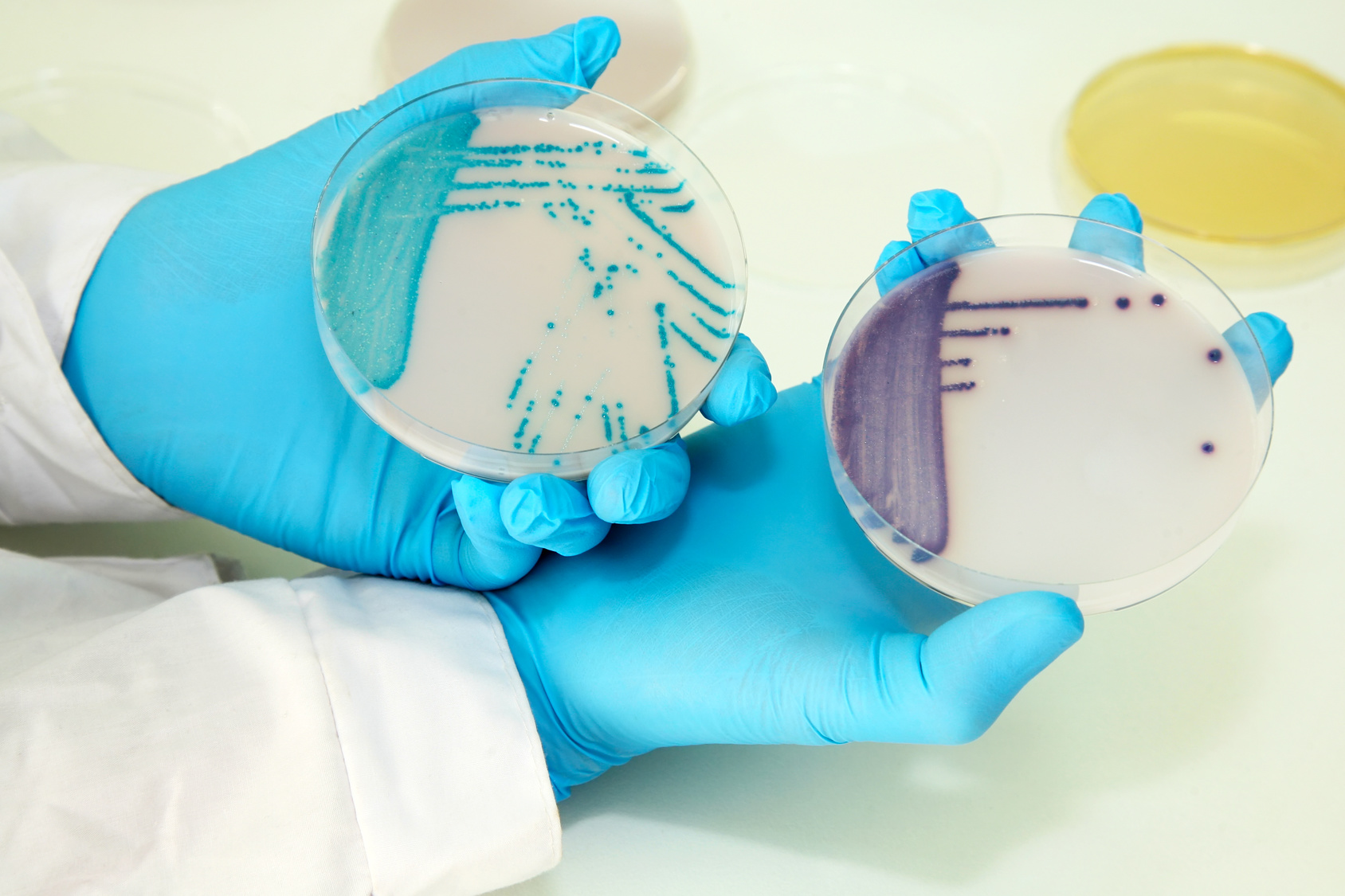 Cálculo de incertidumbre en microbiología